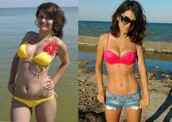 Anna hat mit NexaSlim 10 kg abgenommen